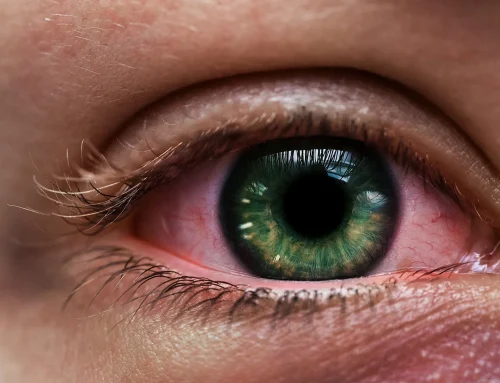 What Causes Dry Eyes and When Should You See a Doctor?
