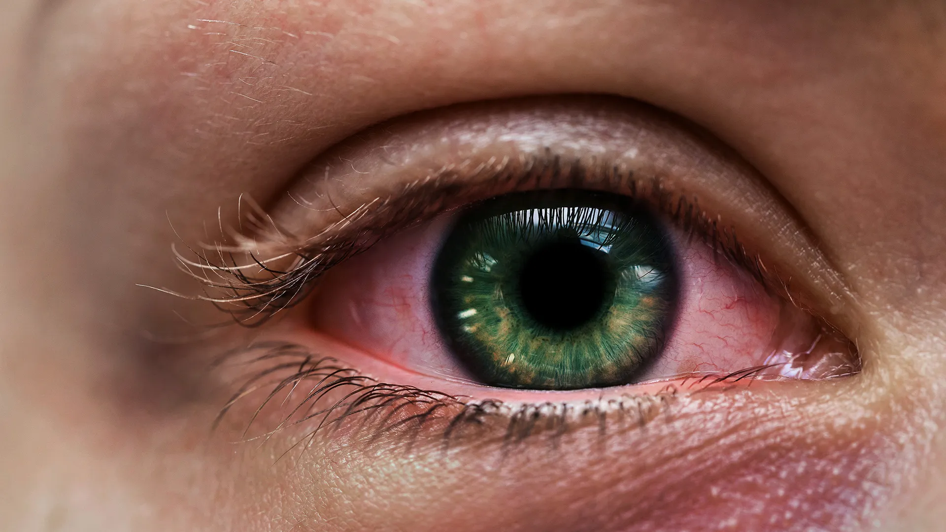 What Causes Dry Eyes and When Should You See a Doctor